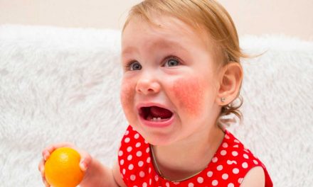 Comment aider votre enfant à faire face à une allergie alimentaire