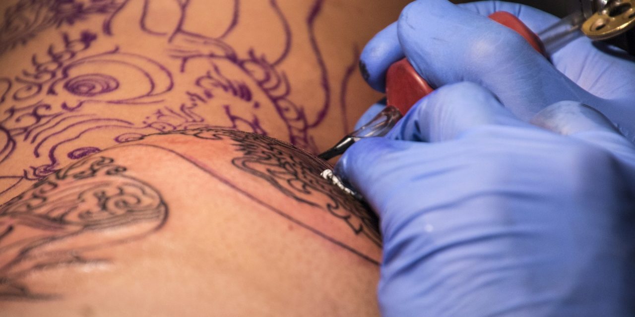 Comment se débarrasser d’un tatouage indésirable ?